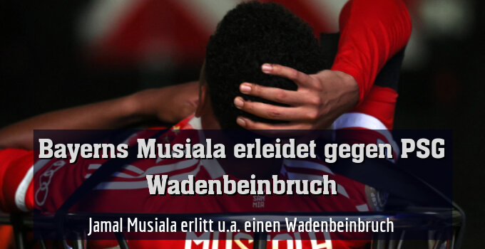 Jamal Musiala erlitt u.a. einen Wadenbeinbruch