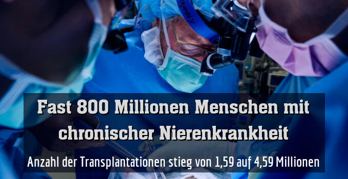 Anzahl der Transplantationen stieg von 1,59 auf 4,59 Millionen
