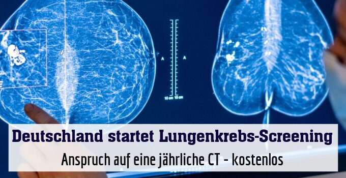 Anspruch auf eine jährliche CT - kostenlos