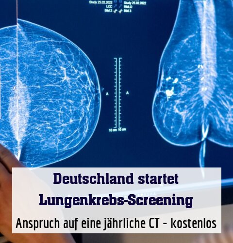 Anspruch auf eine jährliche CT - kostenlos