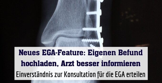 Einverständnis zur Konsultation für die EGA erteilen
