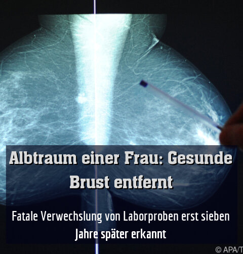 Fatale Verwechslung von Laborproben erst sieben Jahre später erkannt