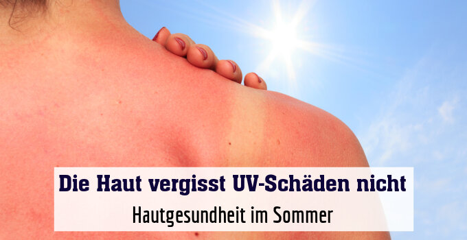 Hautgesundheit im Sommer