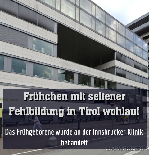Das Frühgeborene wurde an der Innsbrucker Klinik behandelt