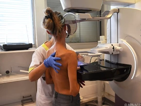 Weltkrebstag: Grüne fordern stärkere Teilnahme an Vorsorgeprogrammen