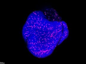 Multidisziplinäre Behandlung der Karotis-Pathologie