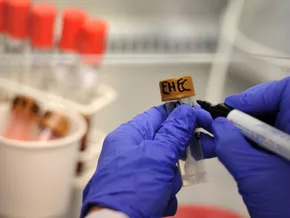 Ehec-Infektionen mit mehreren Toten in Belgien