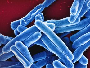 Fieber-Bakterium in Olympia-Stadion entdeckt