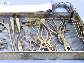 OP-Klemme aus Bauch einer Patientin in Neapel entfernt