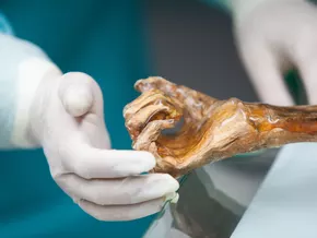 Warum Ötzis Mikrobiom auch heute noch interessant ist