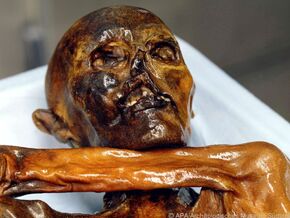 Mumienforscher sieht “Ötzi”-Krankheiten und Umwelt im Fokus