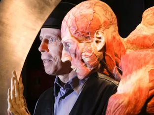 Umstrittener Leichenpräparator Gunther von Hagens gestorben
