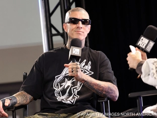 Drummer Travis Barker am Arm operiert
