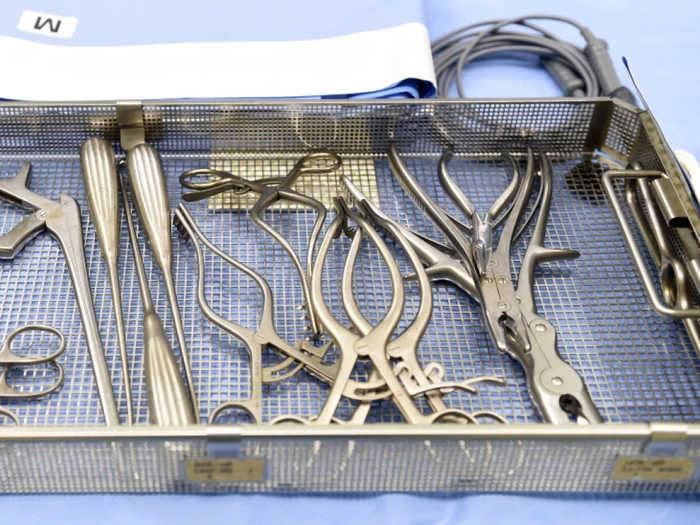 OP-Klemme aus Bauch einer Patientin in Neapel entfernt