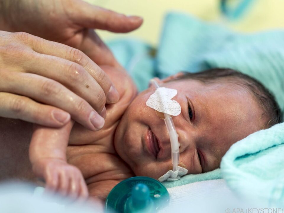 Zu wenig Intensivbetten gibt es für Babys in Wien und Niederösterreich