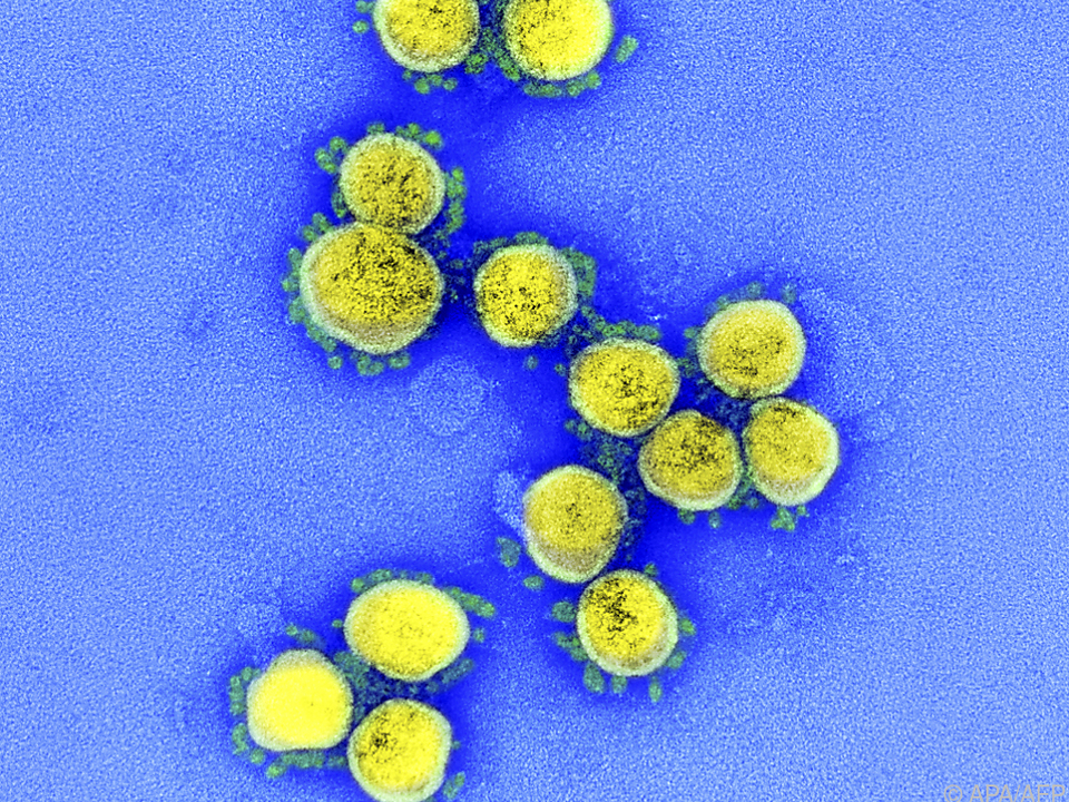 SARS-CoV-2-Infektionen betreffen immer mehr Jüngere Coronavirus mikroskop positiv covid spike sym