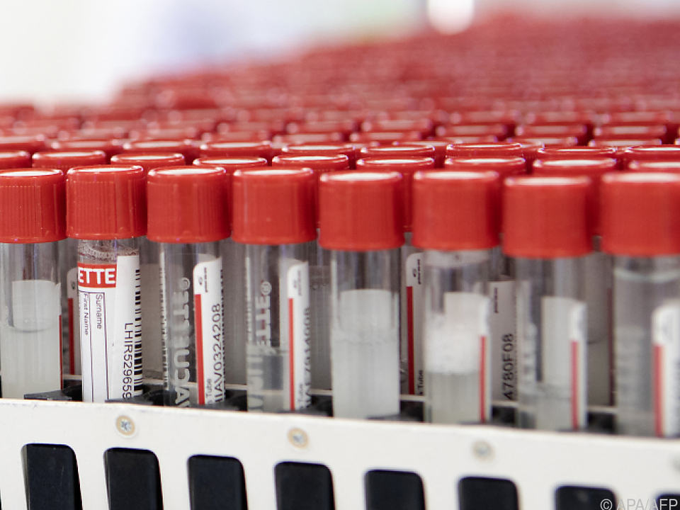 Positiv-Rate der PCR-Tests sei gestern bei 6,3 Prozent