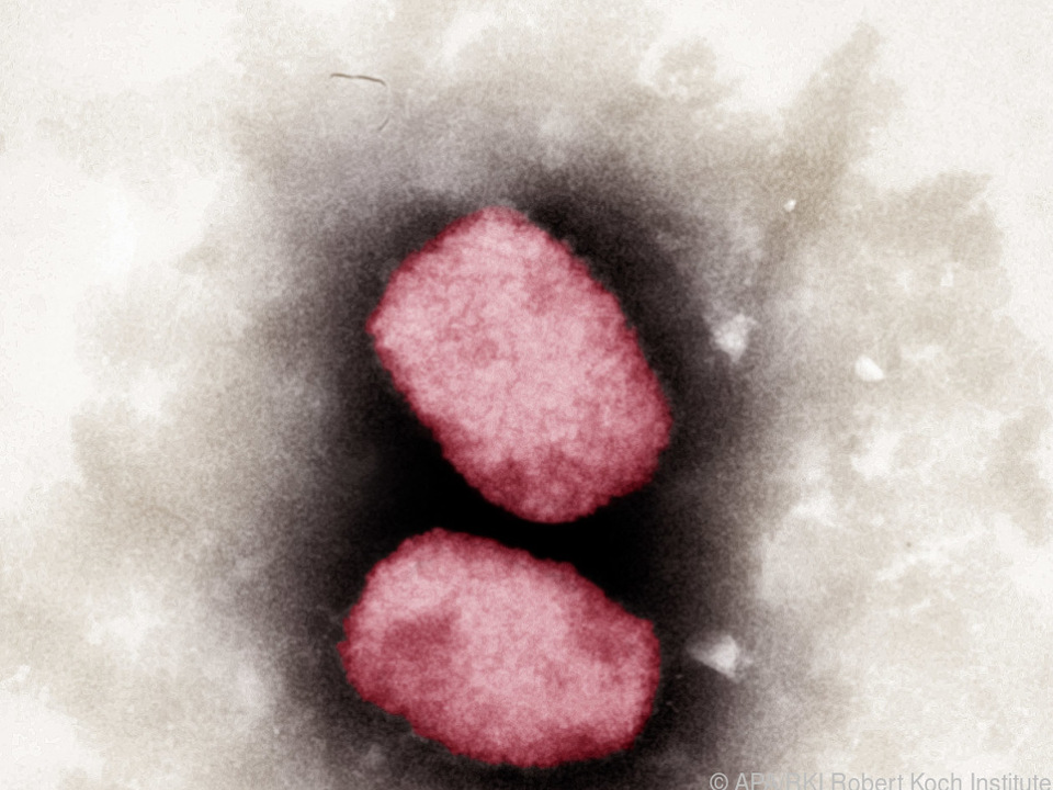 Das Affenpockenvirus ist für die WHO eindämmbar