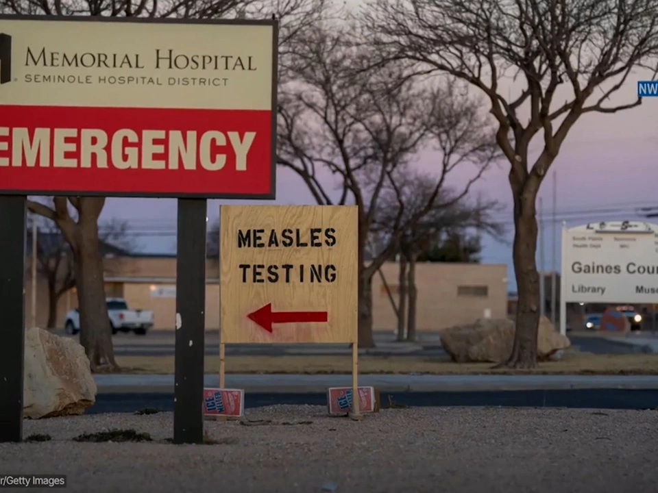 Masern: Rekordausbruch im US-Bundesstaat South Carolina