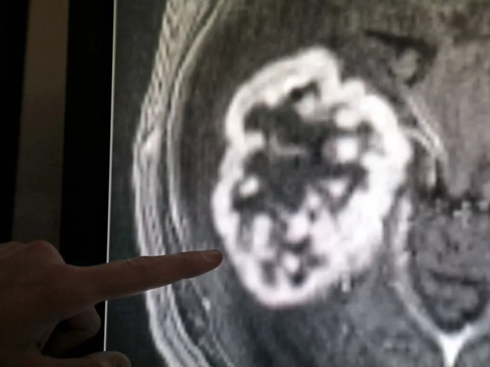 Die Zahl der Diagnosen ist im Steigen begriffen